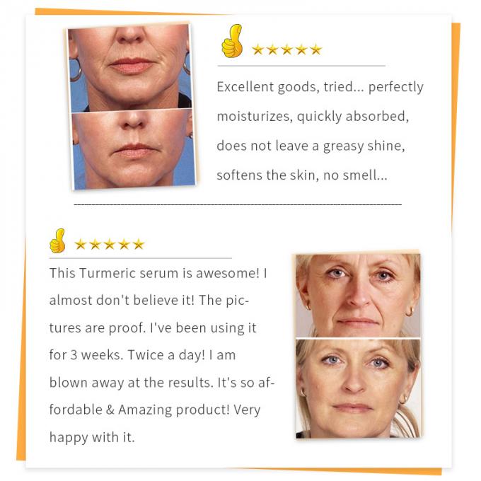 30ml本質の表面血清100%の純粋な赤みの放射皮高度のRosacea 1
