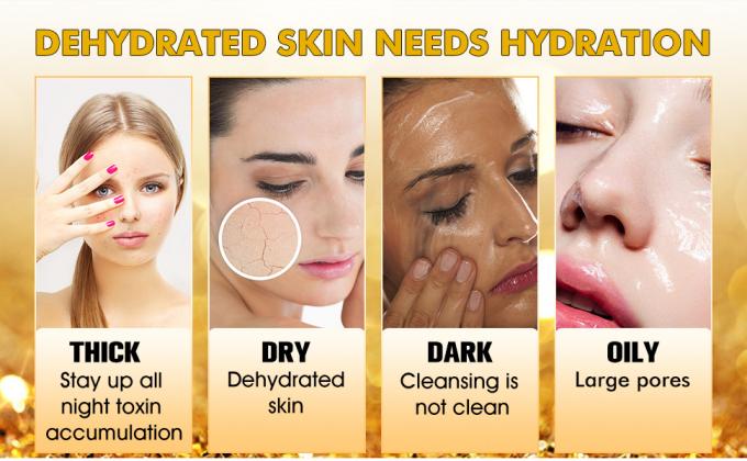 30ml本質の表面血清100%の純粋な赤みの放射皮高度のRosacea 0