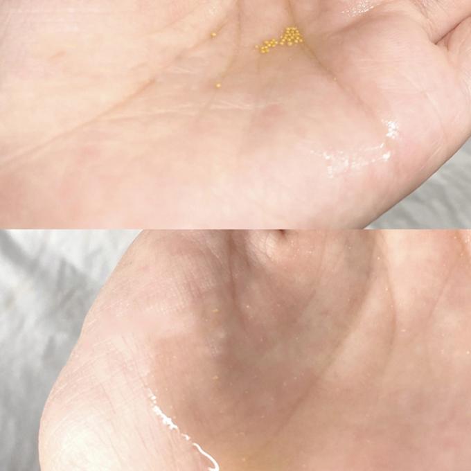 30ml本質の表面血清100%の純粋な赤みの放射皮高度のRosacea 1