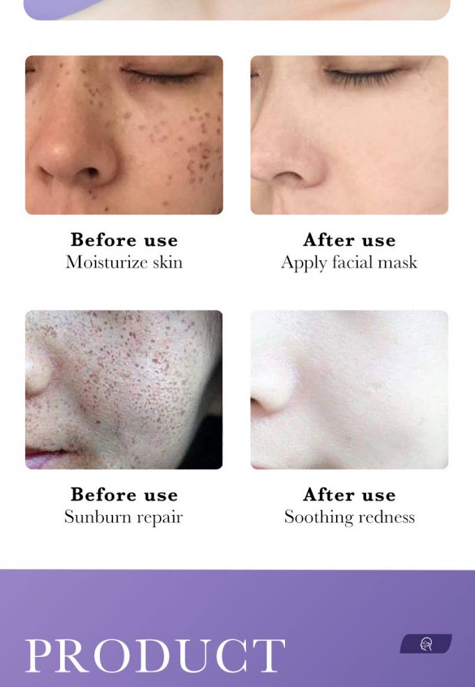 30ml本質の表面血清100%の純粋な赤みの放射皮高度のRosacea 1