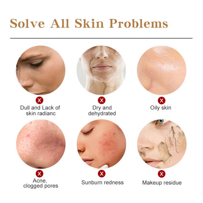 30ml本質の表面血清100%の純粋な赤みの放射皮高度のRosacea 0