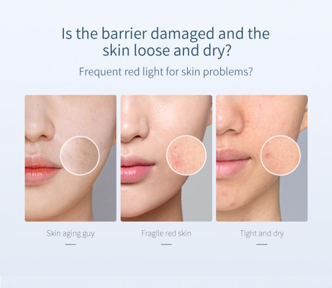 30ml本質の表面血清100%の純粋な赤みの放射皮高度のRosacea 0