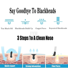 500ml OEMのスキン ケア プロダクト アクネの収縮の鼻のための粗い気孔の美容院のBlackheadsの液体の除去剤