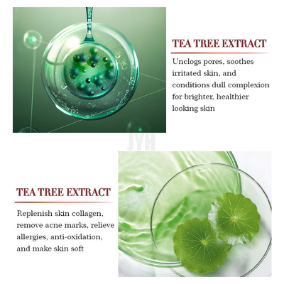 1oz/30ml OEMの有機性茶木の救助の本質の表面血清修理アクネの丘疹の除去剤